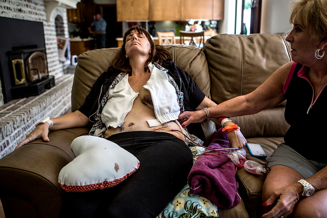 First place, Feature Picture Story - Jessica Phelps / Newark AdvocateFour days after her mastectomy, Stacey was released from the hospital. On the drive home, one of her drains slipped out. Stacey collapsed on the couch, exhausted and in pain while her mom and husband took care of her. 
