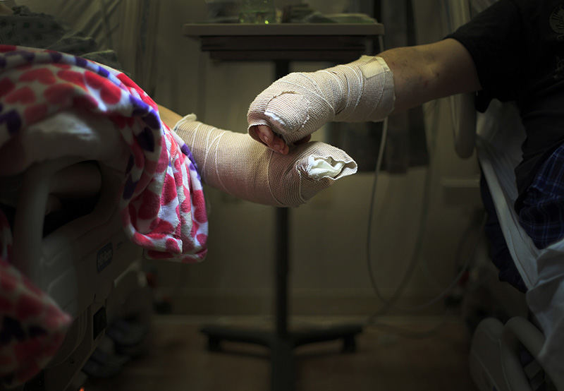 aPortrait - 3rd place - Debbie (left) and Jerry Russell hold hands while talking about how they were injured in the machete attack at Nazareth Mediterranean Cuisine from the hospital beds at Grant Medical Center in Columbus.  The couple spent Valentines Day in the hospital after both having to have multiple surgeries to save their hands.  (Kyle Robertson / The Columbus Dispatch)