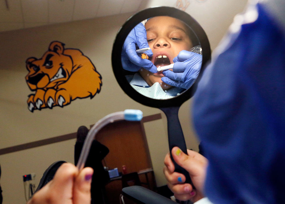 Feature - 2nd placeJanay McCamey 7, watches her teeth get cleaned by dentist Dr. Karyn Boltz of Dublin at Imagine Great Western School in Columbus. Dr. Boltz lets children hold the mirror. It helps them stay still and and satisfies their curiosity.  (Eric Albrecht/The Columbus Dispatch)