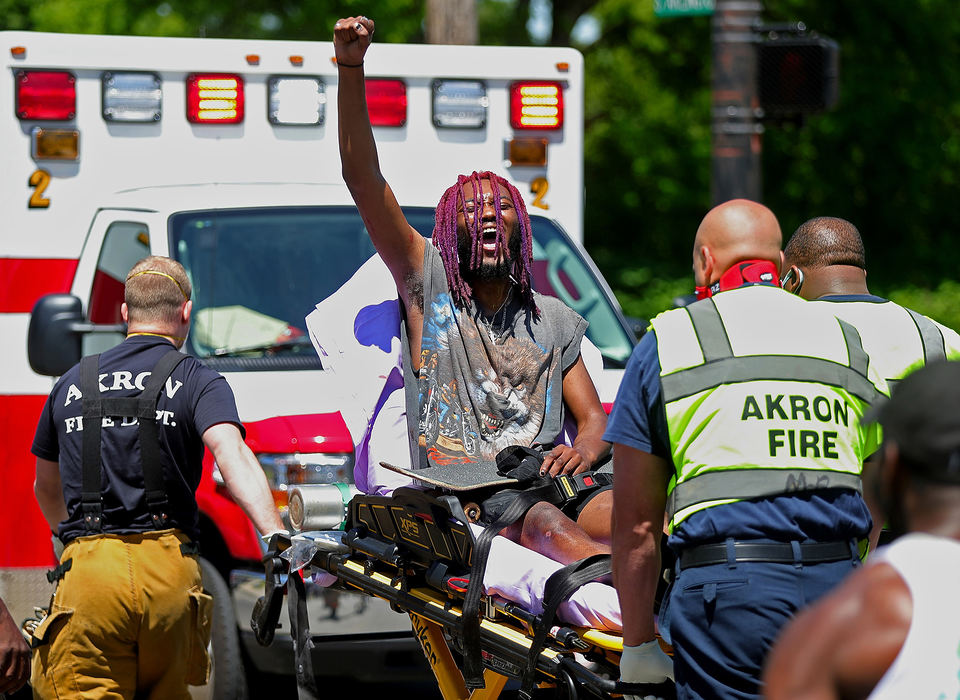 Spot News - 2nd place - Daquane Stephens shouts "black lives matter" as he is hauled away on a stretcher after being hit by a motorist while protesting at the intersection of South Arlington and Johnston in Akron. (Jeff Lange / Akron Beacon Journal)