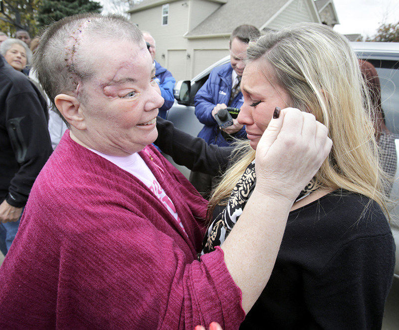 General News - 1st place - Sharon Budd (left) comforts her daughter Kaylee Budd, after she returned to her home in Uniontown. The Edison Middle School teacher was struck by a rock dropped from a bridge overpass onto her vehicle in July. The elder Budd spent three months in Pennsylvania hospitals, and endured five surgeries, before arriving to cheers and applause from family and friends.  (Scott Heckel / The (Canton) Repository)