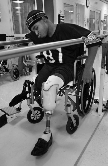 First Place, Ohio Understanding Award - Ed Suba, Jr. / Akron Beacon JournalLeroy Sutton isn't quite sure what to think as he tries on the first of his prosthetic limbs during his initial fitting session at Cleveland Clinic's Hospital for Rehabilitation.