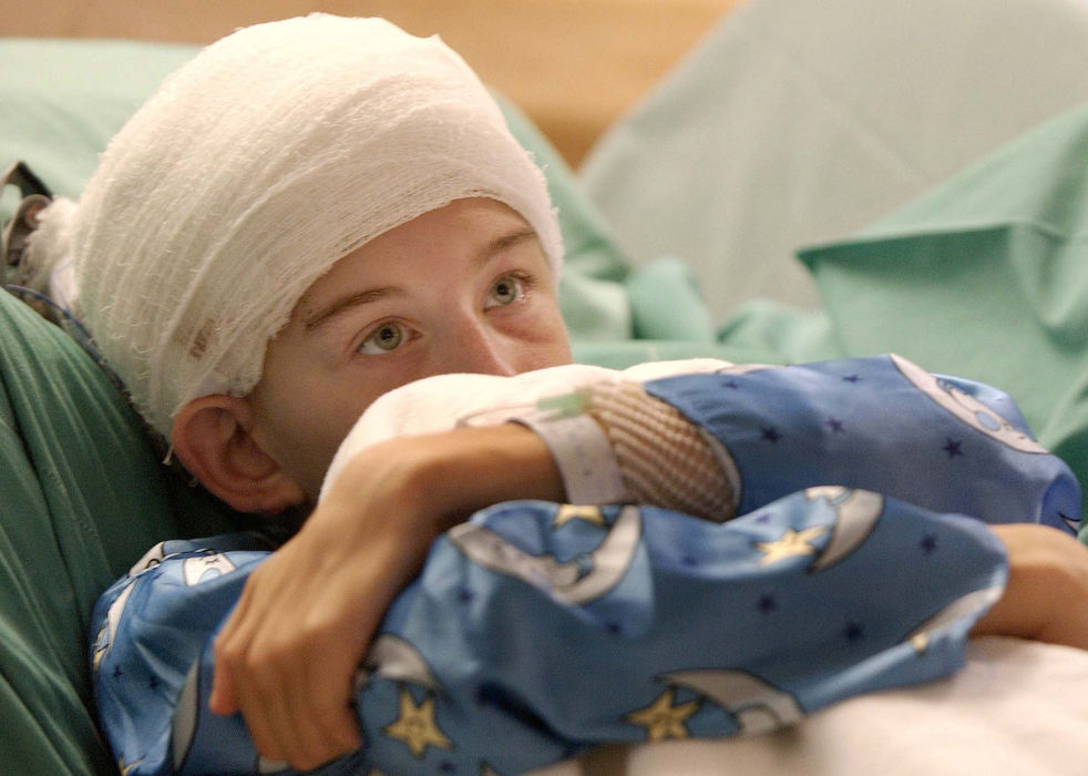 Second Place, Photographer of the Year - John Kuntz / The Plain DealerJennifer Vinkler,13, of Mentor-on-the Lake takes a break from the mapping procedure which induced a couple of seizures that was painful and exhausting to her mentally and physically September 23, 2002 at Rainbows Babies and Childrens Hospital's epileptic center.  Jennifer has electrodes implanted on the surface of her brain that will detect brain wave activity and map her waves for Dr. Monisha Goyal to interrupt to see if Jennifer is a candidate for brain removal surgery to cure her epileptic episodes.  