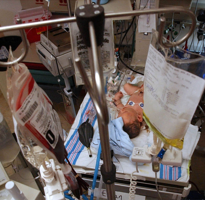 Second Place, Ohio Understanding Award - Bob DeMay / Akron Beacon JournalStilled by drugs to keep him sedated and ease his pain Ethan lies in his isolet the day after his birth. Tubes jutting out of his neck and filled with his blood are lifelines, connecting him to the complex ECMO machine that is keeping him alive.