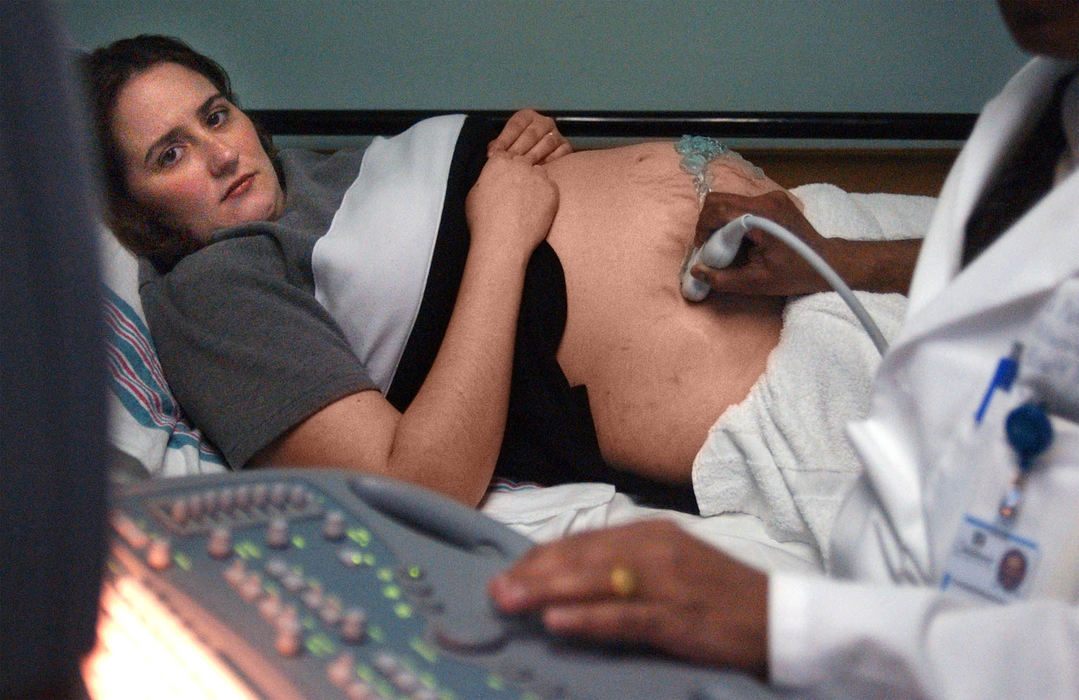 Second Place, Ohio Understanding Award - Bob DeMay / Akron Beacon JournalCathy Moore watches a monitor as Dr C. R. Patel performs an echocardiogram on her baby's heart May 5 to monitor a defect found in earlier testing.