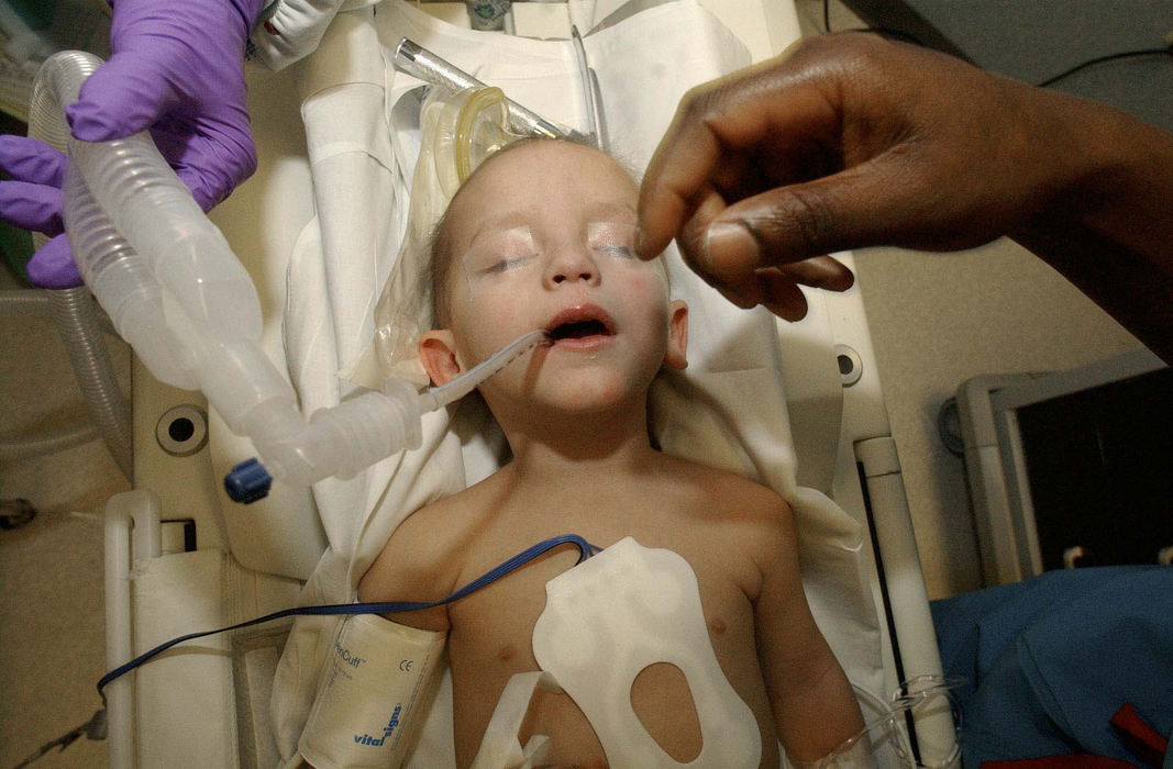 Award of Excellence, Team Picture Story - Daniel Melograna / The News JournalKari Heinrich holds up oxygen tubes Feb. 7 as anesthesiologist Lami Dairo makes sure all is well after putting Luke under for his MRI at Children's Hospital in Columbus.