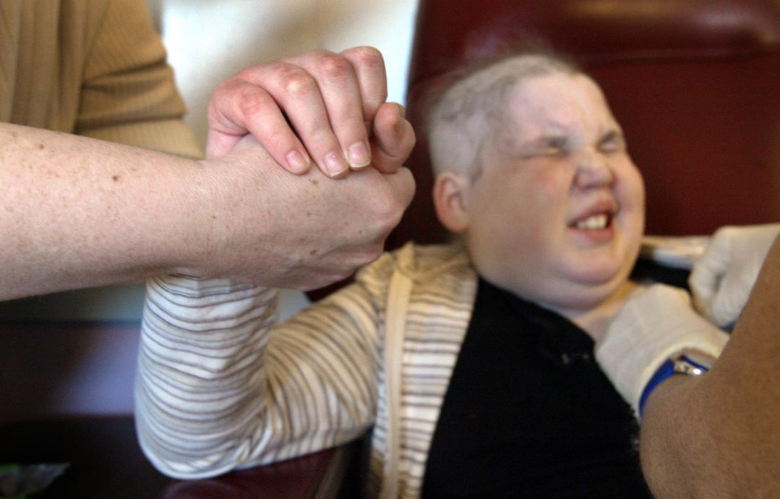 Second Place, Feature Picture Story - Fred Squillante / The Columbus DispatchSherrie holds Abbie's hand as nurse Linda Grooms draws blood at Children's Hospital. 