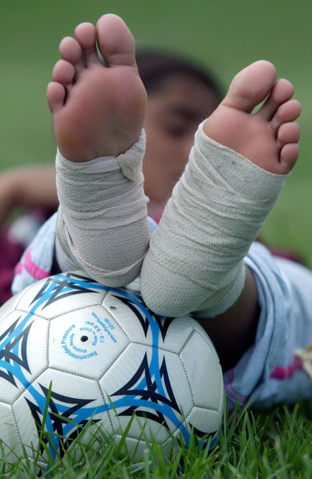 Second Place, Team Picture Story - Tracy Boulian / The Plain DealerRoia Ahmad, 14, of the Afghanistan girls soccer team, rests her feet on a ball when the pain of two strained ankles kept her from playing during a practice session. 