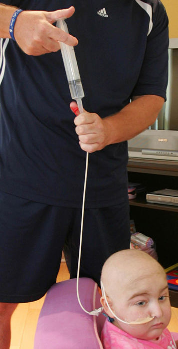 First Place, Feature Picture Story - John Kuntz / The Plain DealerDakota gets her lunch via a feed tube her father, Ken, administers July 10, 2006 at their temporary apartment in Durham, NC.   