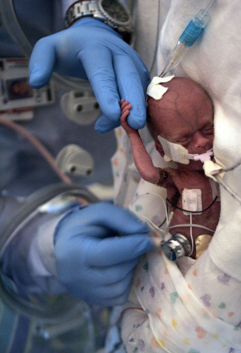 First Place, Feature Picture Story - Chris Russell / The Columbus DispatchAlmost 19,000 babies are born prematurely in Ohio each year and the numbers are increasing. Riley Potter was delivered by Caesarean section after he stopped growing in his mother's womb. He weighed slightly more than a pound when he was born almost four months premature.  Dr. Christopher Timan checks Riley's heartbeat after his arrival at Columbus Children's Hospital's intensive care unit.  Riley was delivered  at a local hospital to first time mother Beth Potter and rushed to  Columbus Children's Hospital Neonatal Care Unit. 