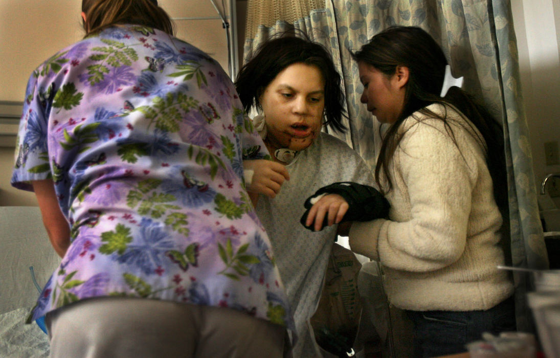 First Place, James R. Gordon Ohio Understanding Award - Gus Chan / The Plain DealerJohanna Orozco gets help from her aunt, Hilda Hernandez and a nurse as she takes her first steps, eleven days after having major surgery to reconstruct her jaw.  