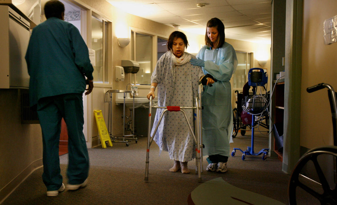 First Place, James R. Gordon Ohio Understanding Award - Gus Chan / The Plain DealerJohanna Orozco takes her first steps with a walker, eleven days after having major surgery to reconstruct her jaw.  Orozco had skin and bone taken from her leg to use in the reconstruction of her jaw.  