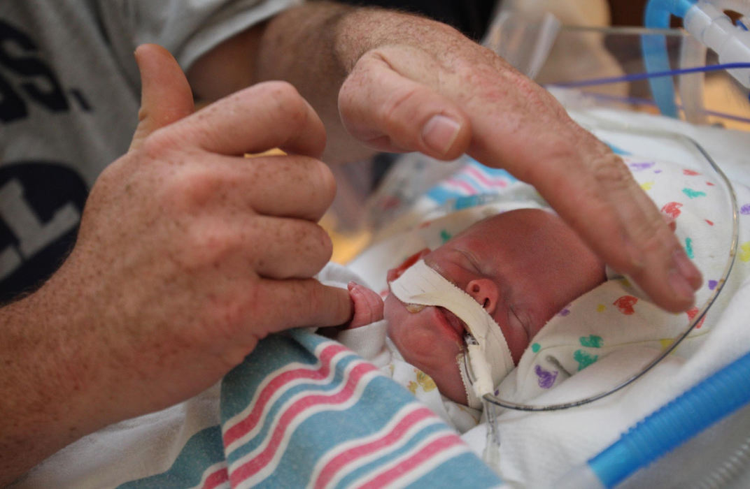 Second Place, James R. Gordon Ohio Understanding Award - Chris Russell / The Columbus Dispatch Riley is temporarily out of his incubator and John shields his eyes from the harsh light and holds his hand before a surgery on his eyes.  Although his health is still fragile he must undergo the surgery or face permanent blindness.  