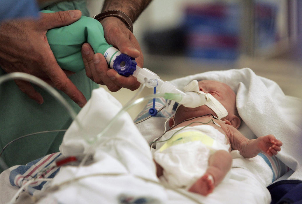 Second Place, James R. Gordon Ohio Understanding Award - Chris Russell / The Columbus DispatchA respiratory technician manually breathes for Riley as he sits on the operating room gurney after surgery and waits to be returned to the safety of his incubator in the NeoNatal Intensive Care Unit.  