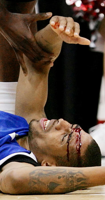 Award of Excellence, Sports Feature - John Kuntz / The Plain DealerMemphis player Antonio Anderson hits the floor after taking a hit on the forehead that drew blood from a fight for a rebound with an Ohio State University player in the first half during the NCAA's South Regional championship game at the Alamodome in San Antonio, Texas. Ohio State advanced to the Final Four in Atlanta.    