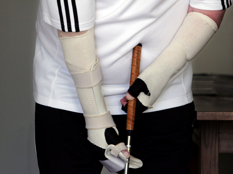 Third Place, Photographer of the Year - Gus Chan / The Plain DealerNorm Martin practices putting for the first time in his dining room.  Martin, who loved to golf before his accident, is regaining the use of his arms after an industrial accident. 