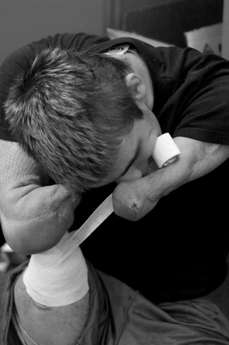 First Place, Sports Picture Story - Michael E. Keating / Cincinnati EnquirerDustin Carter insists on taping his own leg stumps and arm stumps. He uses his stumps and teeth to tear tape during the process.