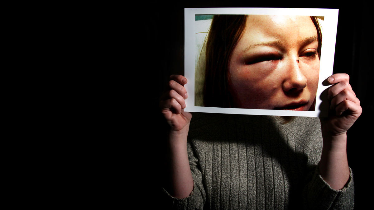 Third Place, News Picture Story - Courtney Hergesheimer / The Columbus DispatchOhio has about eight times as many shelters for animals as for victims of domestic violence. Few other crimes touch as many lives and receive so little attention. Jessica, of Galloway, Ohio, is a survivor of domestic violence. She was severely beaten by her boyfriend of two years who was convicted of a misdemeanor and received six months in jail for his actions. Jessica holds a an image of herself shortly after being beaten, November 5, 2009.