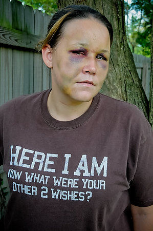 First Place, Portrait Personality - Dave Polcyn / The (Mansfield) News JournalBruises cover April Williams' face a day after she was brutally raped and beaten and held against her will for nearly 12 hours. She came forward to let other women know they need to be careful about the men they let in their life.