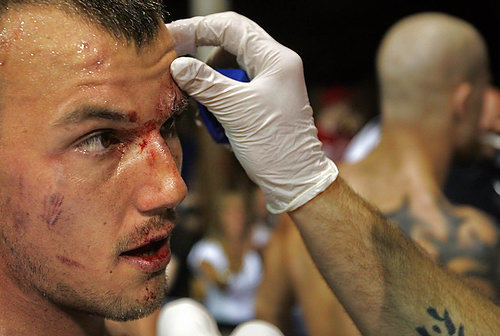 First Place, Sports Picture Story - Ed  Suba Jr / Akron Beacon JournalTerry Johnson has his injuries looked at by the medical staff as Kris Maruna, the man who beat him, leaves the ring, during Caged Madness, an amateur mixed martial arts event.