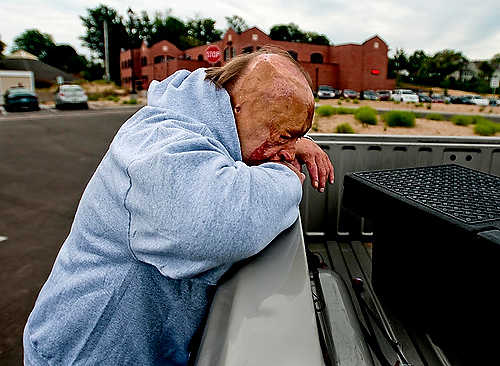 Second place, Student Photographer of the Year - Hannah Potes / Kent State UniversityKlavon rests against the side of his daughter Erin Klavon's truck after a long day at Great Lakes Burn Camp. It had been five years since Klavon, it's founder, had stepped foot on the grounds of the camp. "I think it bothers Dad that he's not so involved anymore," Erin said. "But he loves the place anyway. I think he's just happy he can help kids like him."