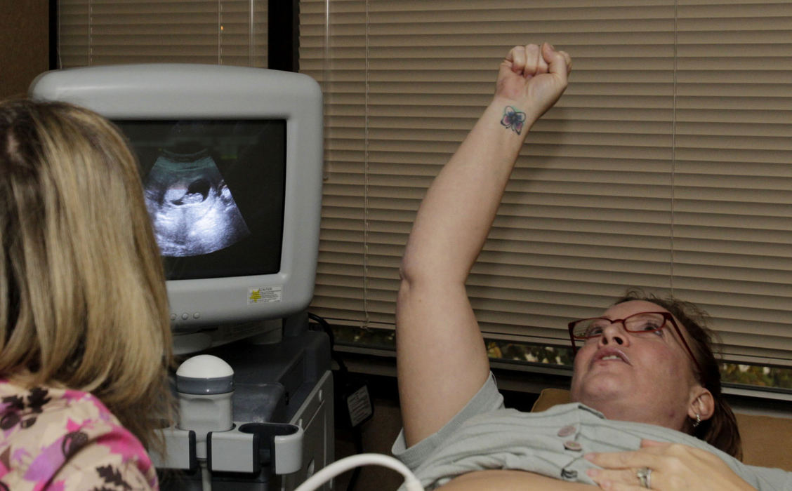 Award of Excellence, Feature Picture Story - Karen Schiely / Akron Beacon JournalMichelle Lang-Schock cheers as the ultrasound performed by sonographer Bonnie Fierro shows that her baby survived her mastectomy surgery. 