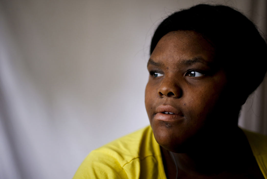 Second Place, James R. Gordon Ohio Undertanding Award - Eamon Queeney / The Columbus DispatchJaymone Smith, 16, poses for a photograph in the basement of her North Linden home, Wednesday afternoon, August 14, 2013. Smith was shot in the hand on March 30th when gunfire erupted at the small night club she was attending during a party for her cousin. Jaymone said she thinks about three or four people started shooting but she is not sure who shot her. 