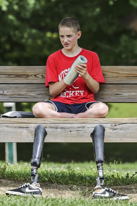 Second Place, Student Photographer of the Year - Alex Holt / University of KentuckyJonathan Horst, 12 from Milwaukee, Wi, takes a minute to cool off in the shade during an intense kickball game Sunday afternoon, July 21, 2013. This is Jonathan's first trip to camp, and he was looking forward to the ropes course. Kickball was one of many events the campers are taking part in at Camp Joy this week. Camp Joy is working with the Amputee Coalition of America to bring children who have amputations or limb differences together and challenge them with fun events such as sports, canoeing, a ropes course, zip-lining, etc. 