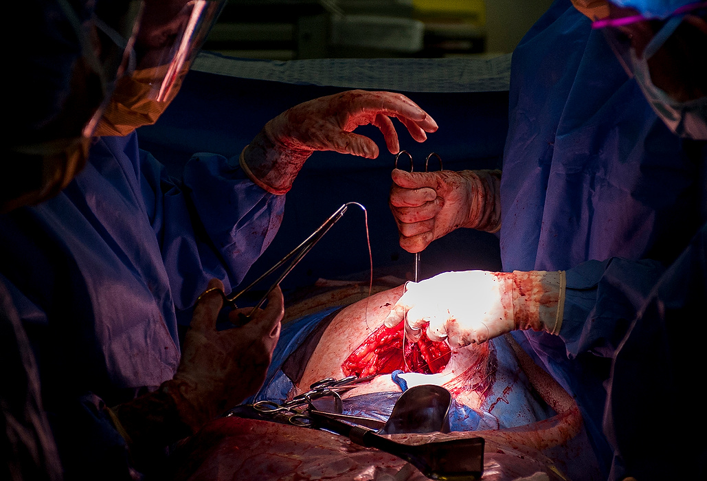 Third Place, Feature Picture Story - Logan Riely / Ohio UniversityResident Dr. Emily Burnette holds a pair of scissors in preparation to sew Semantha Smith's stomach closed after they delivered the baby boy. 