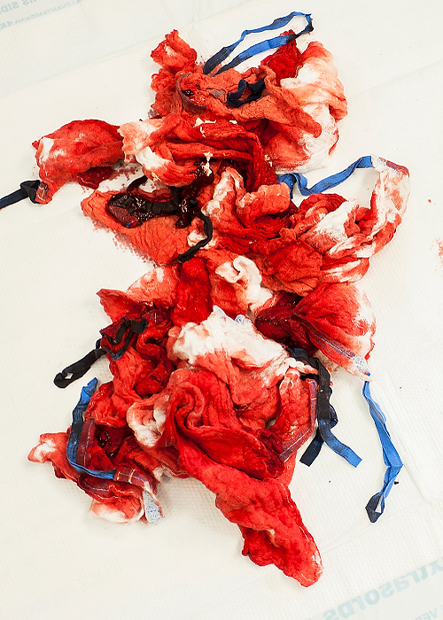 Third Place, Feature Picture Story - Logan Riely / Ohio UniversityBlood soaked cloths lay on the ground awaiting to be thrown away after the C-section. The blue tags are made with radioactive particles so they can be seen under an    x-ray just in case one was accidentally left inside of a patient. 