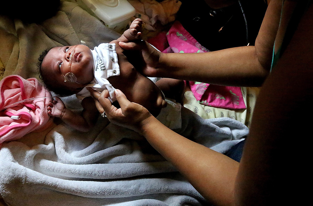 Second Place, James R. Gordon Ohio Understanding Award - Brooke LaValley / The Columbus DispatchMichelle Jackson smiles while being readied for a bath by her mother Mickaela  Jackson at their home in Columbus, Ohio on August 12, 2014. Michelle lost her twin sister Melissa due to complications eight days after their birth. Michelle survived and is home, on oxygen and a heart monitor.