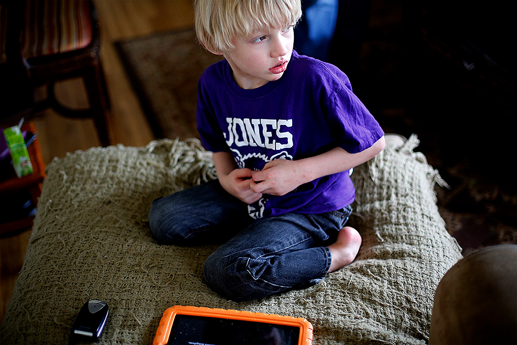 First Place, Photographer of the Year - Large Market - Eamon Queeney / The Columbus DispatchAlex Oliver, 5, of Upper Arlington, pauses for a moment while he listens to a song on repeat on a tablet in his family's living room. Alex has severe epilepsy as well as autism and his parents are proponents of legalizing marijuana for medicinal purposes. Alex's mother Ali Oliver says Alex will have almost a hundred small seizures a day where he will blank out for 30 to 40 seconds with a massive seizure coming roughly once a week. 