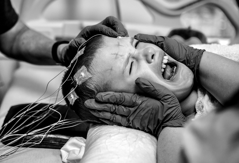 Award of Excellence, Feature - Jessica Phelps / Newark AdvocatePhoenix screams out as techs at Nationwide Children's Hospital in Columbus, Ohio, prepare the electrodes on her head for an EEG. Phoenix recently had a couple of grand mal seizures. Phoenix is mostly non-verbal and fall on the Autism spectrum. It is common for people with Autism to have epilepsy. 