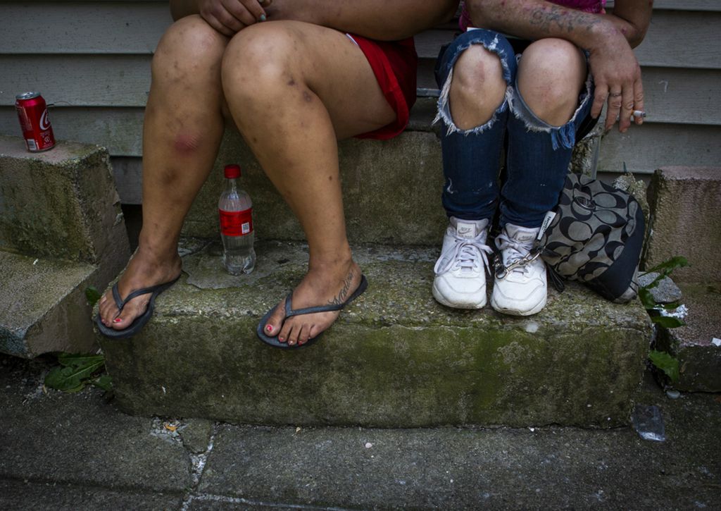 Second Place, Chuck Scott Student Photographer of the Year - Madeleine Hordinski / Ohio UniversityHeroin has plagued cincinnati for a long time, and the summer of 2019 was no exception. Overdoses kept a consistent grip in several neighborhoods, and certain areas in and around cincinnati were hit harder than others. This photo essay examines the communities and people in Cincinnati whose lives have been permanently altered by this epidemic. Here, two women sit on a stoop on east McMicken avenue in Over-the-Rhine, smoking crack cocaine, on Thursday, July 11, 2019. one says she plans to inject heroin later. She's been using the drug for 20 years. 