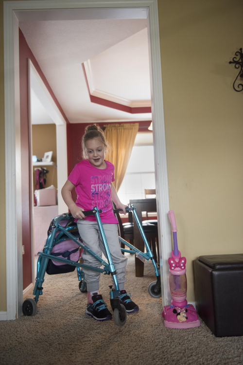 Second Place, Larry Fullerton Photojournalism Scholarship - Alexandria Skowronski / Ohio UniversitySophia Smith is a seven-year-old girl from Streetsboro, Ohio who is learning how to walk again, in her home and in therapy, on March 12, 2018, after a recent foot and nerve surgery.  Smith was born with spastic diplegia, a form of cerebral palsy, and was in a wheelchair until she was three.  She learned to walk then, but it was very limited and was in a wheelchair after other surgeries later in life including the most recent surgery; here she is learning how to walk again.   