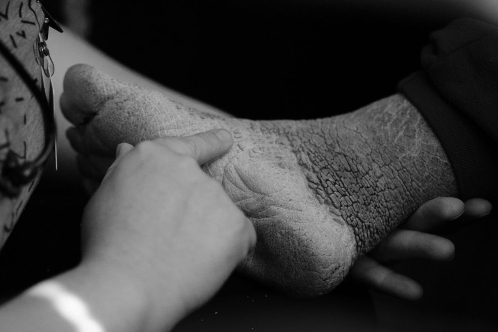 Third Place, Photographer of the Year - Large Market - Joshua A. Bickel / The Columbus DispatchNurse Beka Copley checks on the condition of David Dempsey's foot as she chats with him while on a home visit on Wednesday, October 23, 2019 in Proctorville, Ohio.