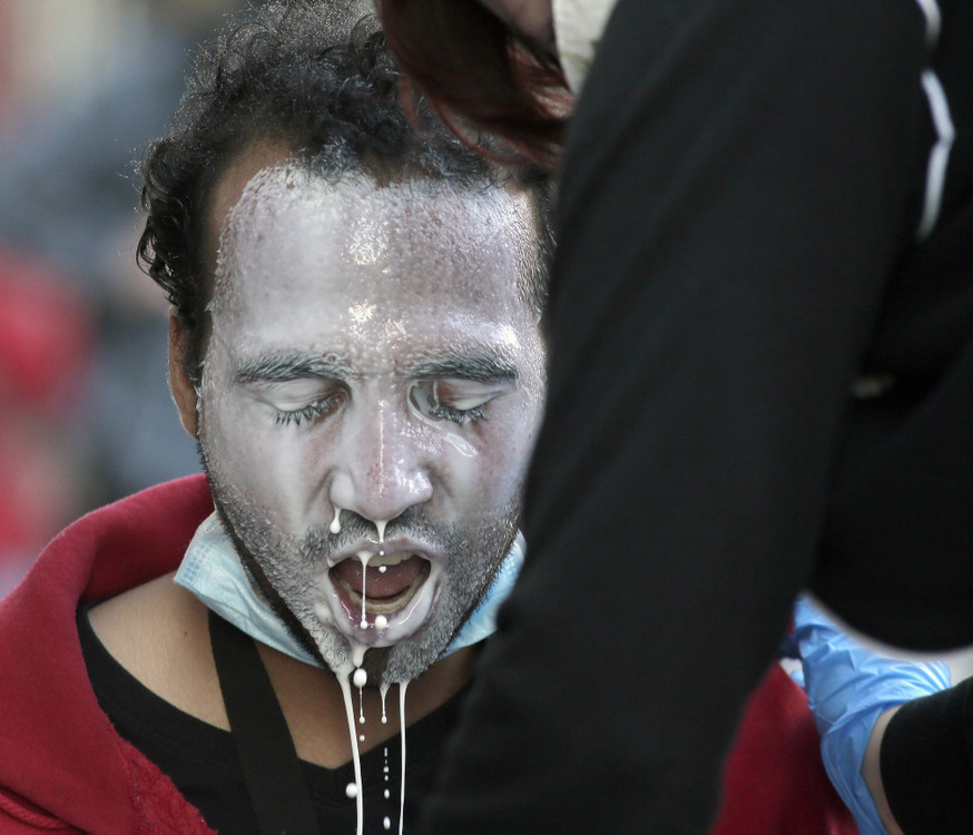 First Place, James R. Gordon Ohio Understanding Award - Barbara J. Perenic / The Columbus Dispatch, “Political Climate of Southeast Ohio”A man who was pepper sprayed receives assistance from a street medic as hundreds of people continued to clash with police on the third day of protests in downtown Columbus on Saturday, May 28, 2020. 