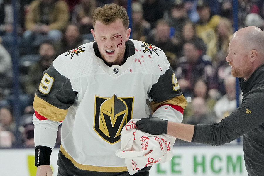 Ron Kuntz Sports Photographer of the Year - First Place Vegas Golden Knights center Jack Eichel (9) is handed a towel after he took a puck to the eye during the third period of the NHL hockey game against the Columbus Blue Jackets at Nationwide Arena. Vegas won 3-2 in a shootout.  (Adam Cairns / The Columbus Dispatch)